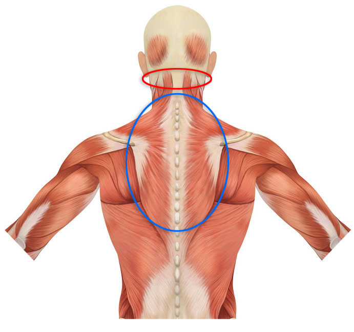 Neck Muscle Pain Headache Dizziness